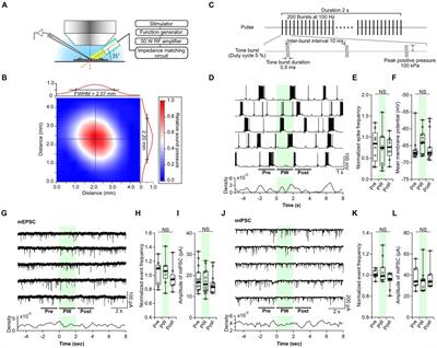 Repetitive pulsed-wave ultrasound stimulation suppresses neural activity by modulating ambient GABA levels via effects on astrocytes